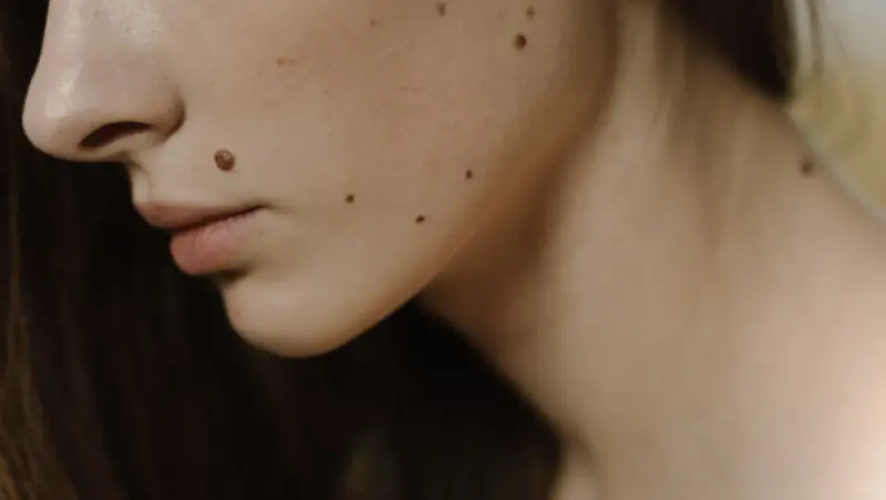 A close view of facial skin in natural light